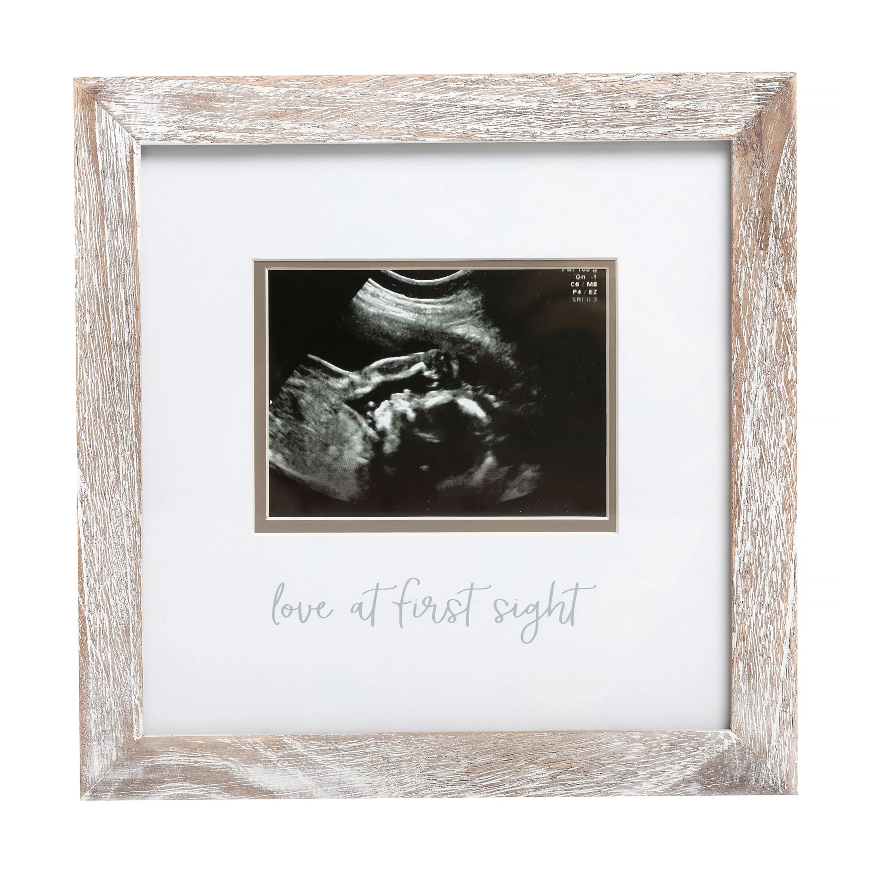 sonogram photo frame